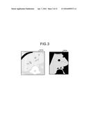 ULTRASONIC DIAGNOSTIC APPARATUS diagram and image