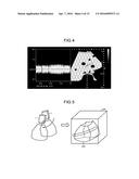 ULTRASONIC DIAGNOSTIC APPARATUS diagram and image