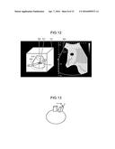 ULTRASONIC DIAGNOSTIC APPARATUS diagram and image