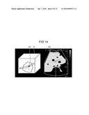 ULTRASONIC DIAGNOSTIC APPARATUS diagram and image