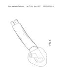 Radially-Firing Electrohydraulic Lithotripsy Probe diagram and image