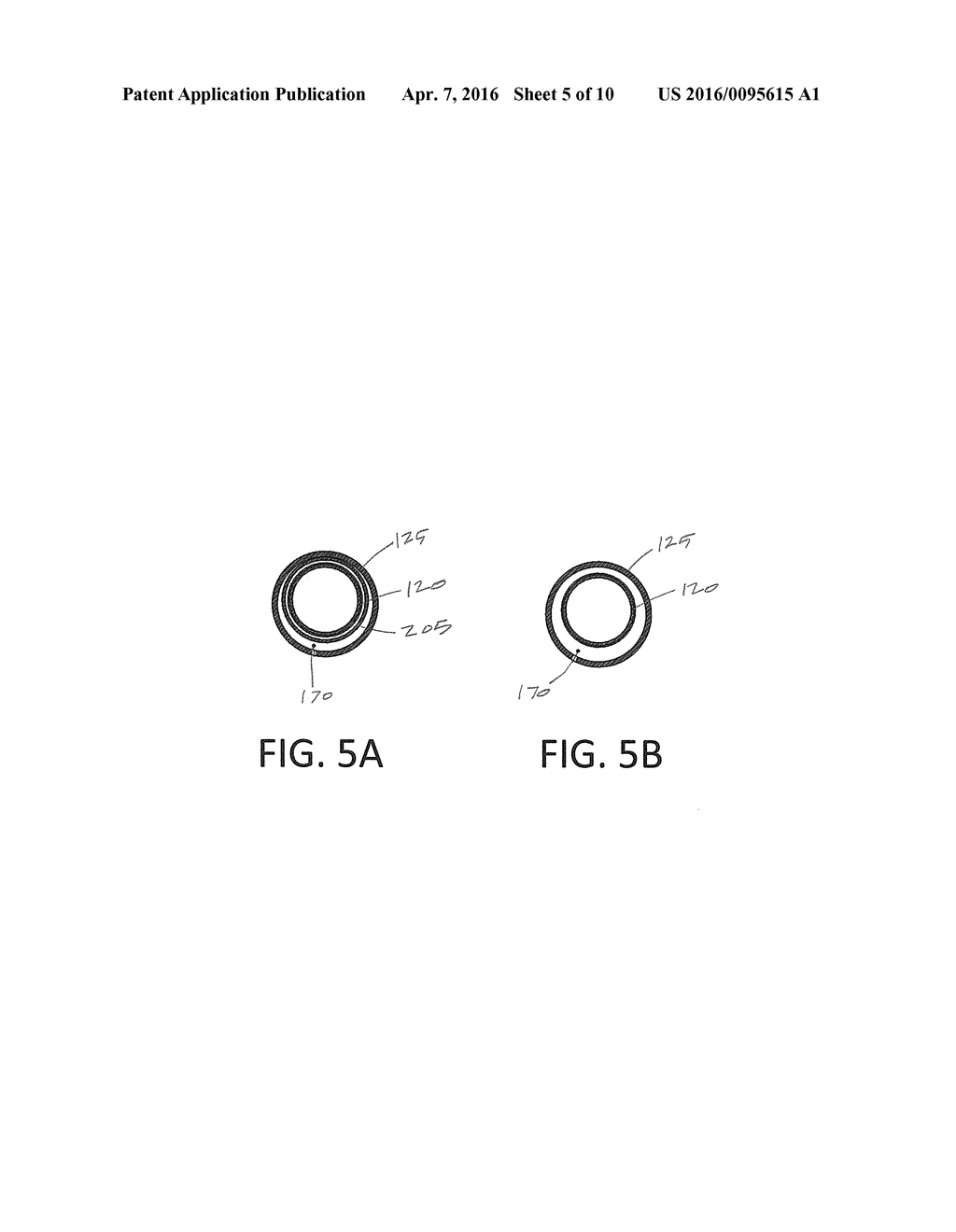 SURGICAL DEVICE AND METHOD OF USE - diagram, schematic, and image 06