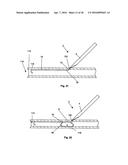 ACCESS AND CLOSURE DEVICE AND METHOD diagram and image