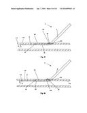 ACCESS AND CLOSURE DEVICE AND METHOD diagram and image