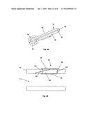 ACCESS AND CLOSURE DEVICE AND METHOD diagram and image