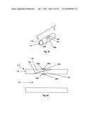 ACCESS AND CLOSURE DEVICE AND METHOD diagram and image