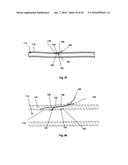 ACCESS AND CLOSURE DEVICE AND METHOD diagram and image