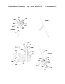 CLAMPING DEVICE FOR USE WITH AN ANATOMIC EXTERNAL FIXATION SYSTEM diagram and image