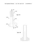 CLAMPING DEVICE FOR USE WITH AN ANATOMIC EXTERNAL FIXATION SYSTEM diagram and image