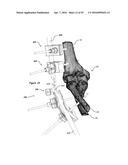 CLAMPING DEVICE FOR USE WITH AN ANATOMIC EXTERNAL FIXATION SYSTEM diagram and image