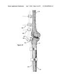 CLAMPING DEVICE FOR USE WITH AN ANATOMIC EXTERNAL FIXATION SYSTEM diagram and image