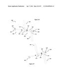 CLAMPING DEVICE FOR USE WITH AN ANATOMIC EXTERNAL FIXATION SYSTEM diagram and image