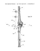 CLAMPING DEVICE FOR USE WITH AN ANATOMIC EXTERNAL FIXATION SYSTEM diagram and image