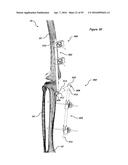 CLAMPING DEVICE FOR USE WITH AN ANATOMIC EXTERNAL FIXATION SYSTEM diagram and image