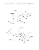 CLAMPING DEVICE FOR USE WITH AN ANATOMIC EXTERNAL FIXATION SYSTEM diagram and image