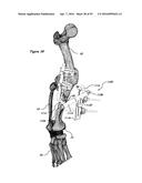 CLAMPING DEVICE FOR USE WITH AN ANATOMIC EXTERNAL FIXATION SYSTEM diagram and image