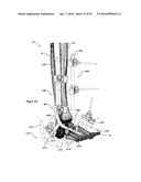 CLAMPING DEVICE FOR USE WITH AN ANATOMIC EXTERNAL FIXATION SYSTEM diagram and image