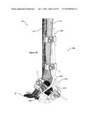 CLAMPING DEVICE FOR USE WITH AN ANATOMIC EXTERNAL FIXATION SYSTEM diagram and image