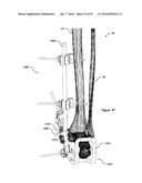 CLAMPING DEVICE FOR USE WITH AN ANATOMIC EXTERNAL FIXATION SYSTEM diagram and image