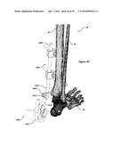 CLAMPING DEVICE FOR USE WITH AN ANATOMIC EXTERNAL FIXATION SYSTEM diagram and image