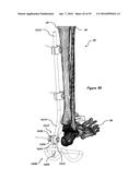 CLAMPING DEVICE FOR USE WITH AN ANATOMIC EXTERNAL FIXATION SYSTEM diagram and image