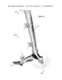 CLAMPING DEVICE FOR USE WITH AN ANATOMIC EXTERNAL FIXATION SYSTEM diagram and image