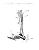 CLAMPING DEVICE FOR USE WITH AN ANATOMIC EXTERNAL FIXATION SYSTEM diagram and image