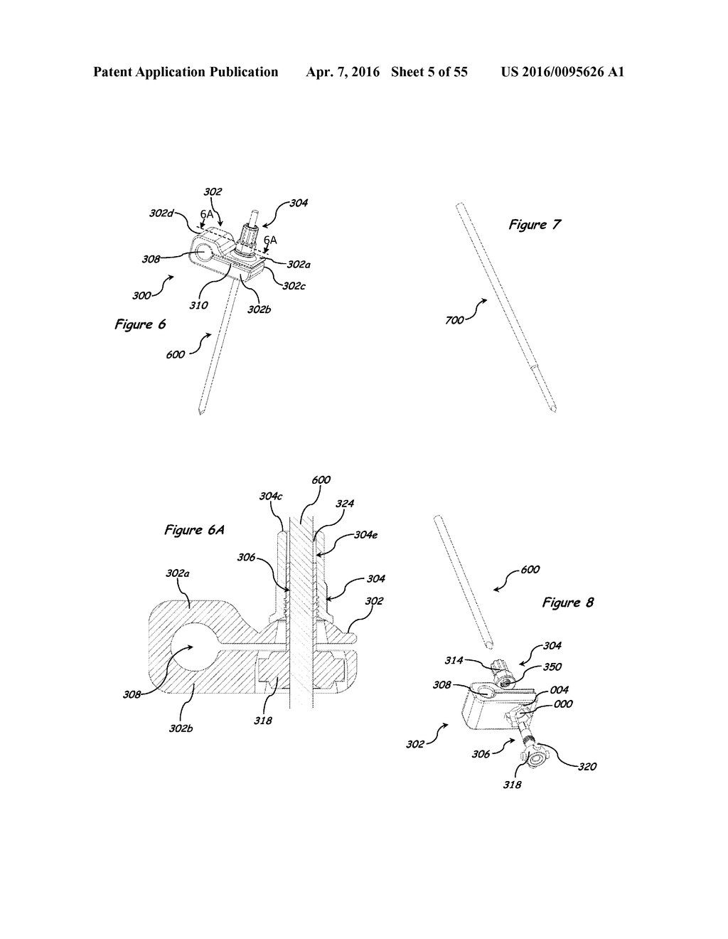 ANATOMIC EXTERNAL FIXATION SYSTEM FOR THE ANKLE - diagram, schematic, and image 06