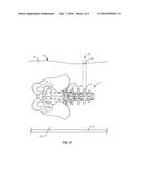 SPINAL IMPLANT SYSTEM AND METHOD diagram and image