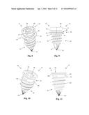 Bone Plate System and Related Methods diagram and image