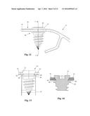 Bone Plate System and Related Methods diagram and image