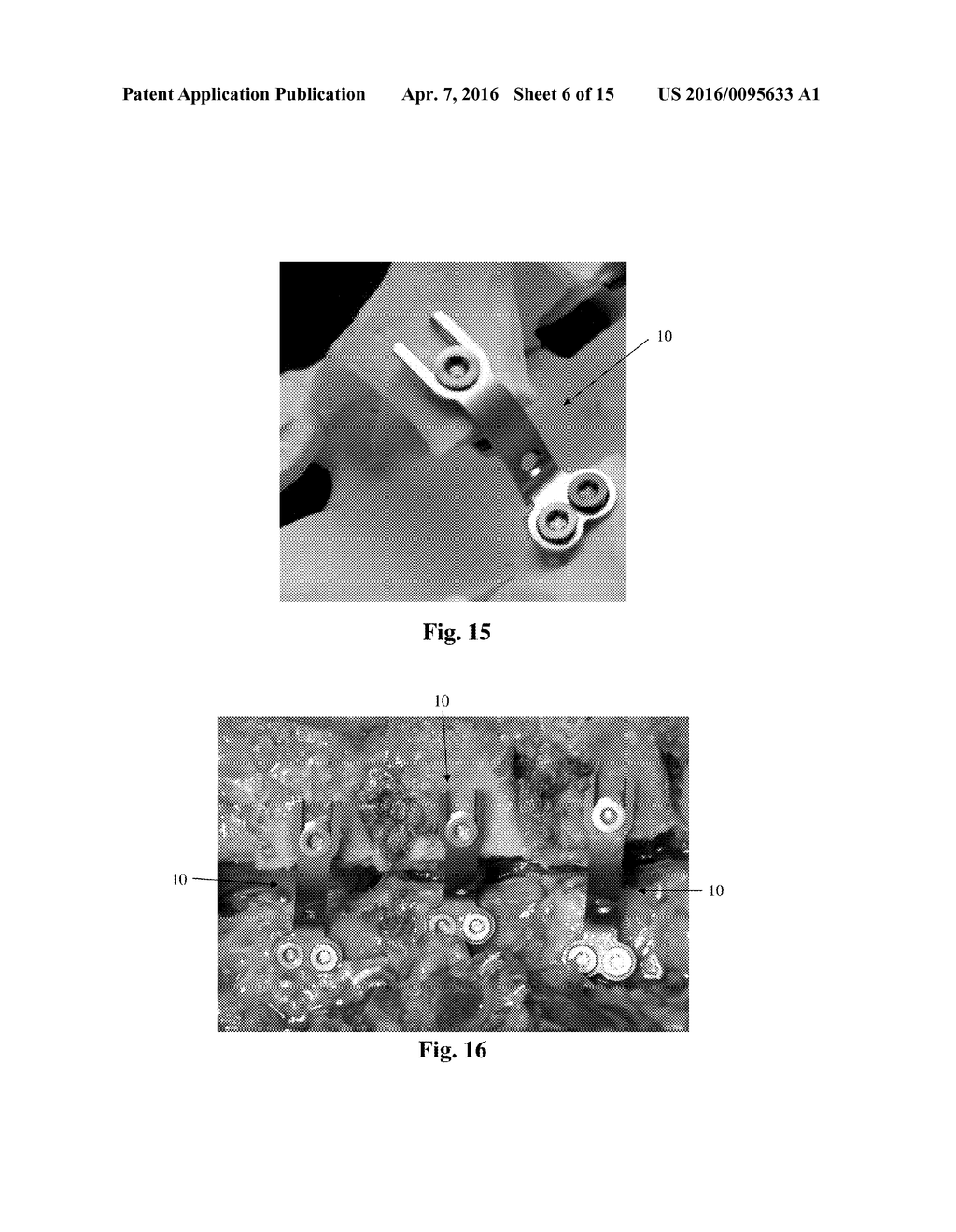 Bone Plate System and Related Methods - diagram, schematic, and image 07