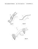 Bone Plate System and Related Methods diagram and image