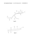 Bone Plate System and Related Methods diagram and image