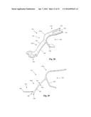 Bone Plate System and Related Methods diagram and image