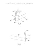 Bone Plate System and Related Methods diagram and image