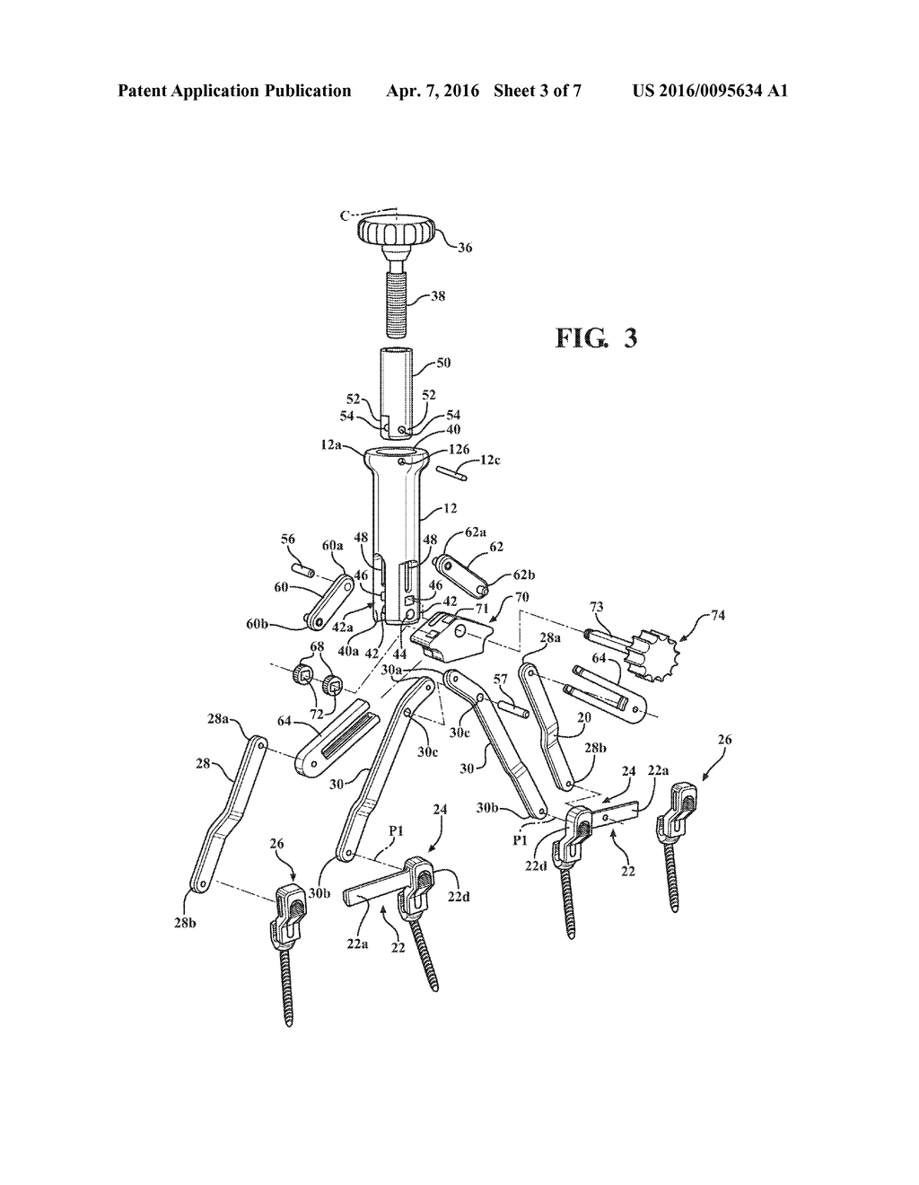 Osteotomy Instrument - diagram, schematic, and image 04