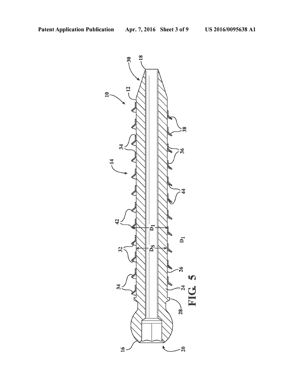 ORTHOPEDIC SCREW - diagram, schematic, and image 04