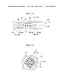 VAGINAL WALL INCISION INSTRUMENT diagram and image