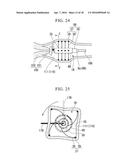 VAGINAL WALL INCISION INSTRUMENT diagram and image