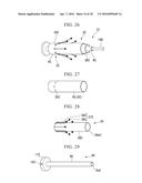 VAGINAL WALL INCISION INSTRUMENT diagram and image