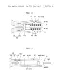 VAGINAL WALL INCISION INSTRUMENT diagram and image