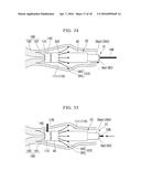 VAGINAL WALL INCISION INSTRUMENT diagram and image