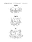 TOOTH ATTACHMENT PLACEMENT DEVICE diagram and image