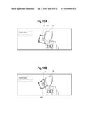 TOOTH ATTACHMENT PLACEMENT DEVICE diagram and image