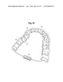 TOOTH ATTACHMENT PLACEMENT DEVICE diagram and image