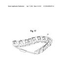 TOOTH ATTACHMENT PLACEMENT DEVICE diagram and image