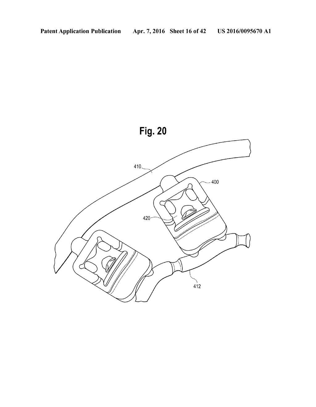 TOOTH ATTACHMENT PLACEMENT DEVICE - diagram, schematic, and image 17