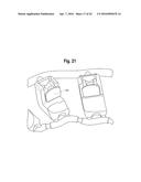 TOOTH ATTACHMENT PLACEMENT DEVICE diagram and image