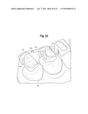 TOOTH ATTACHMENT PLACEMENT DEVICE diagram and image